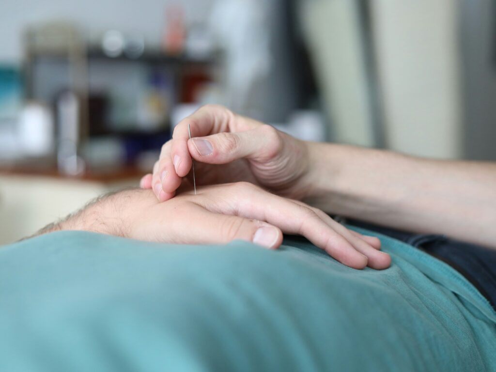 Acupuntura para la ansiedad: tratamiento natural en Madrid